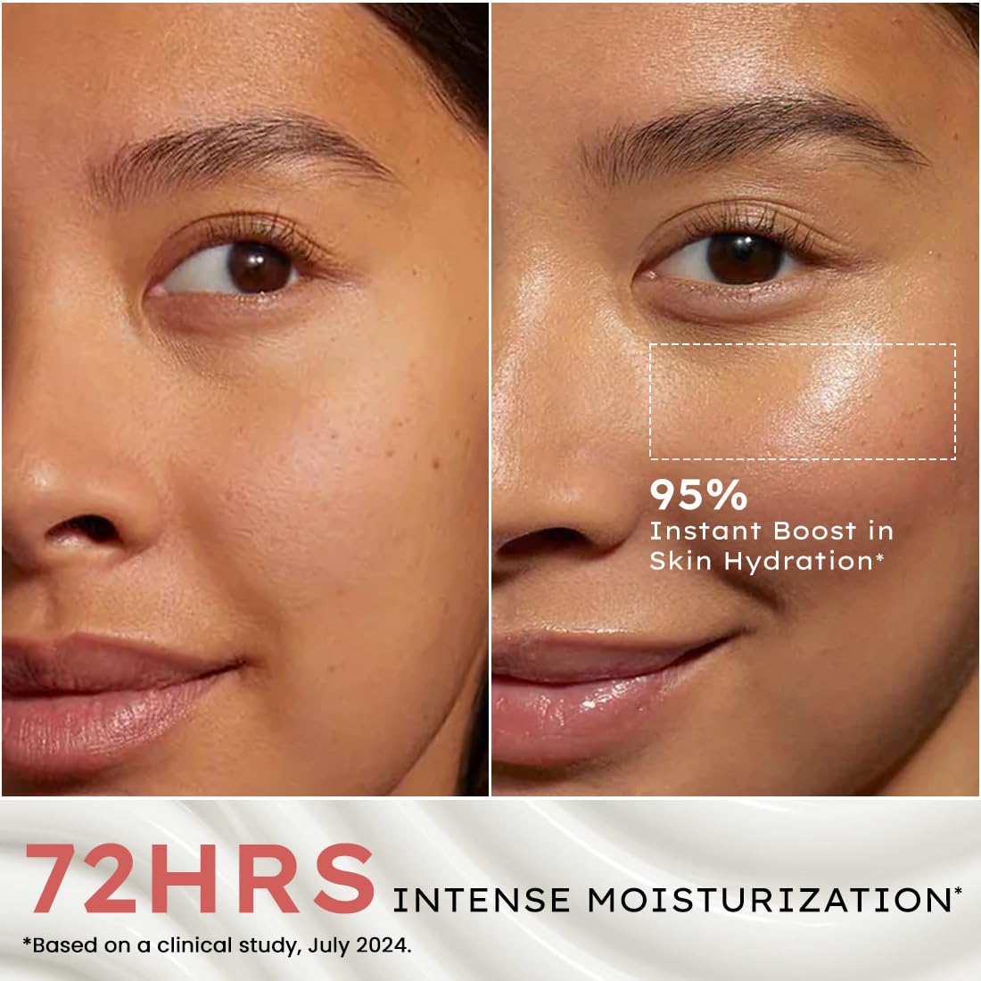 Before and after comparison of a woman's face with text about intense moisturization and hydration.