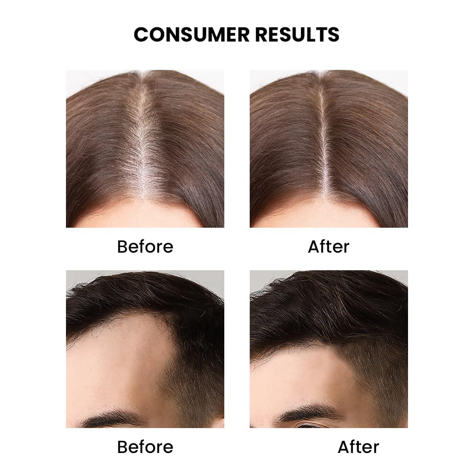 Before and after hair treatment results on a person's head.