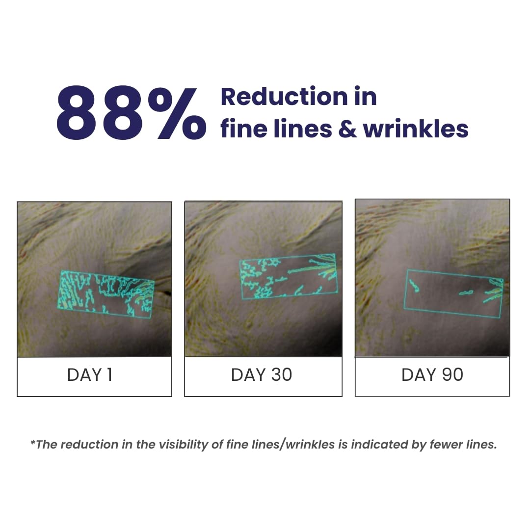 Before-and-after comparison of fine lines and wrinkles with 88% reduction shown over 90 days.