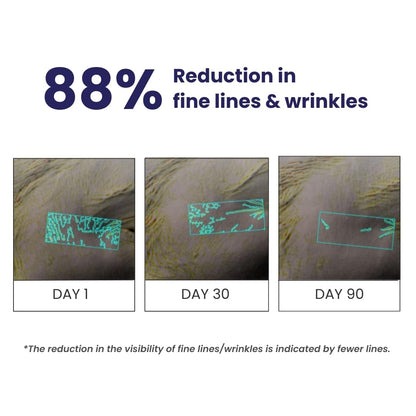 Before-and-after comparison of fine lines and wrinkles with 88% reduction shown over 90 days.