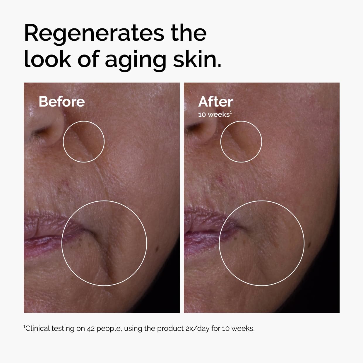 Before and after skin regeneration showing reduced wrinkles and fine lines.