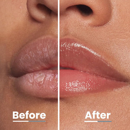 Before and after comparison of lips with a clear lip balm application.
