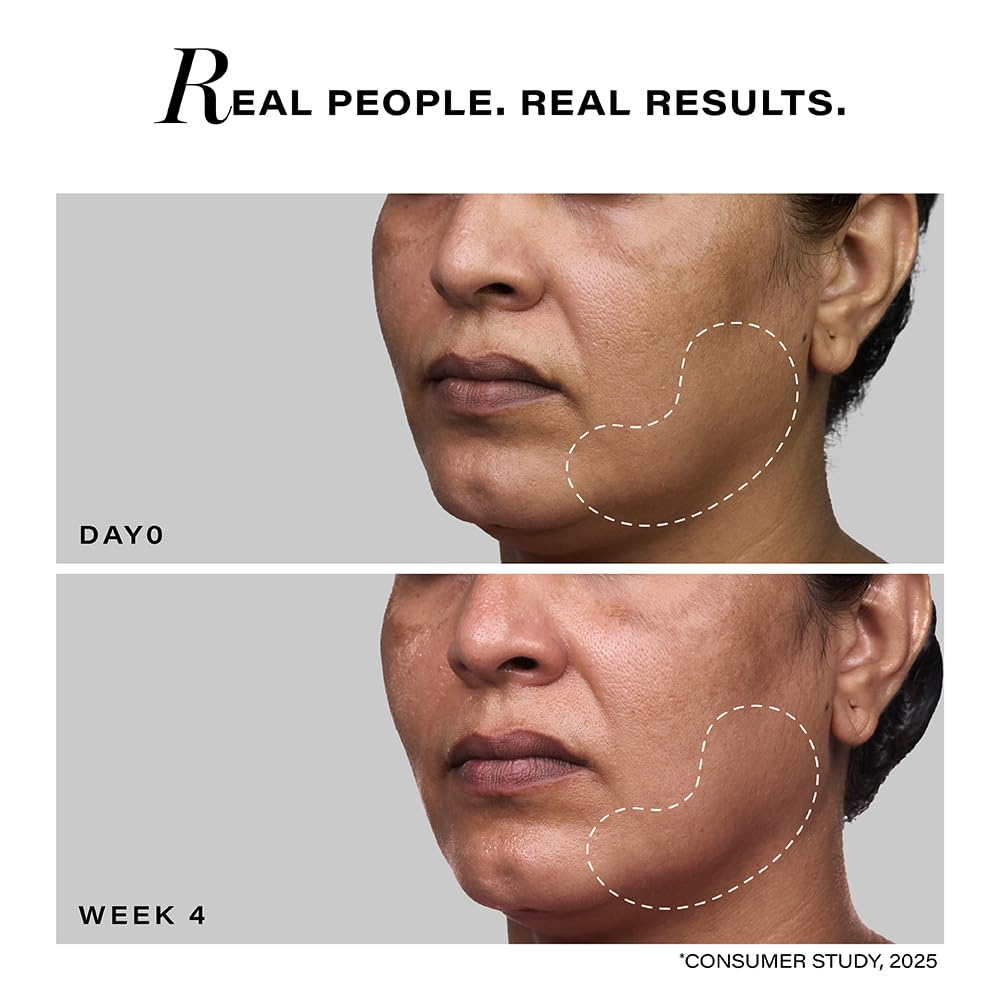 Before and after comparison of a person's face with text 'Real People. Real Results.'