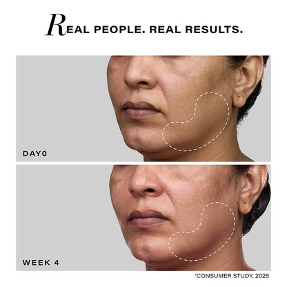 Before and after comparison of a person's face with text 'Real People. Real Results.'