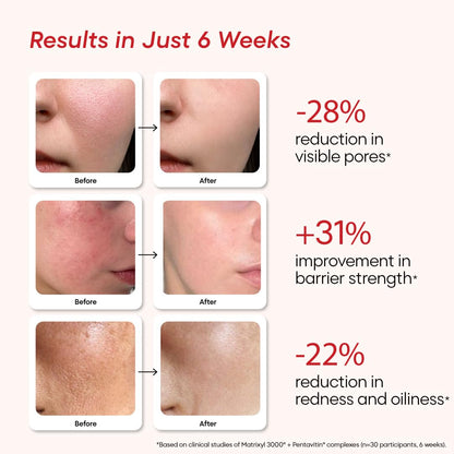 Revive Face Serum | 12% Niacinamide, Azelaic Acid & Ceramides | Refine Pore, Clear & Smooth Skin Tone | For Oily, Sensitive & Dry Skin | Men & Women | Clinically Patented Actives | 30 Ml