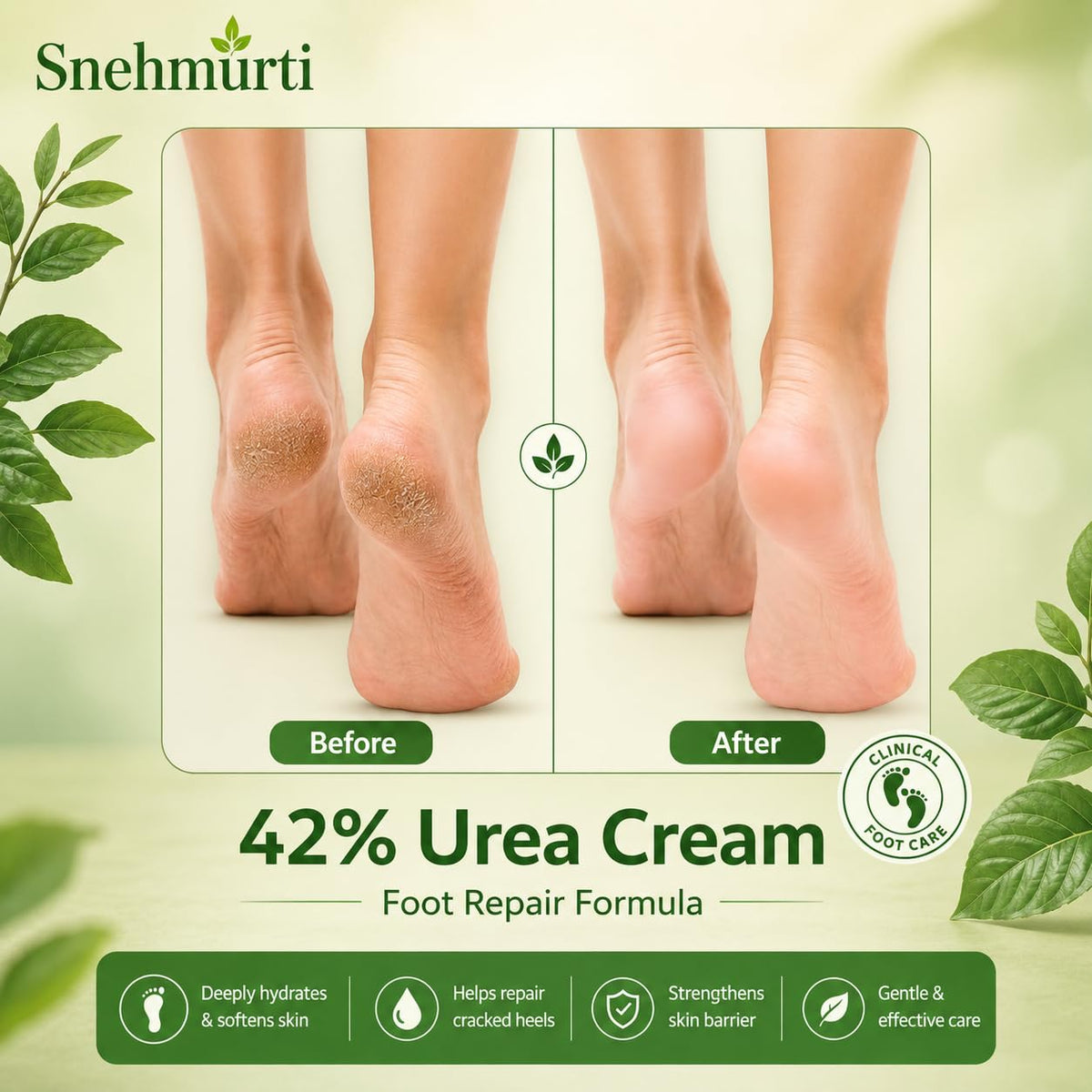 SNEHMURTI 42% Urea Cream for cracked heels with 2% Salicylic Acid 200 g | intensive foot repair formula | skin-friendly | dermatologist-approved