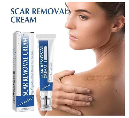 Scar Removal Cream for Skin Recovery & Scar Care | Moisturizing Formula for Smoother-Looking Skin | Helps Reduce the Appearance of Marks