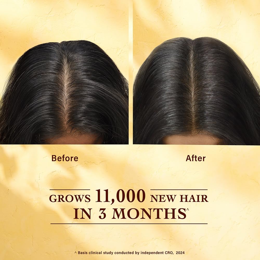 Before and after comparison of hair growth with text indicating 11,000 new hairs grown in 3 months.