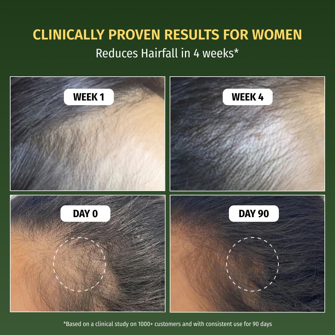 Vilvah Hair Growth Serum | Redensyl & Rosemary Serum for Hair Fall Control & Improved Hair Density | Supports Healthier Hair Growth & Stronger Hair | Nourishes Scalp & Balances Scalp Ecosystem | 30 ml