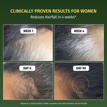 Vilvah Hair Growth Serum | Redensyl & Rosemary Serum for Hair Fall Control & Improved Hair Density | Supports Healthier Hair Growth & Stronger Hair | Nourishes Scalp & Balances Scalp Ecosystem | 30 ml