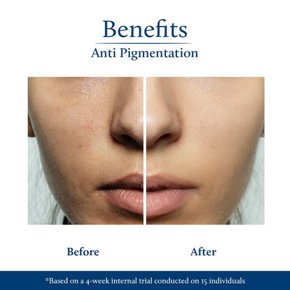 Blue Nectar Rice Water Kojic Acid Face Serum for Pigmentation & Dark Spots Removal | Anti Pigmentation Serum for Face with Mushroom (13 Herbs, 30ml)