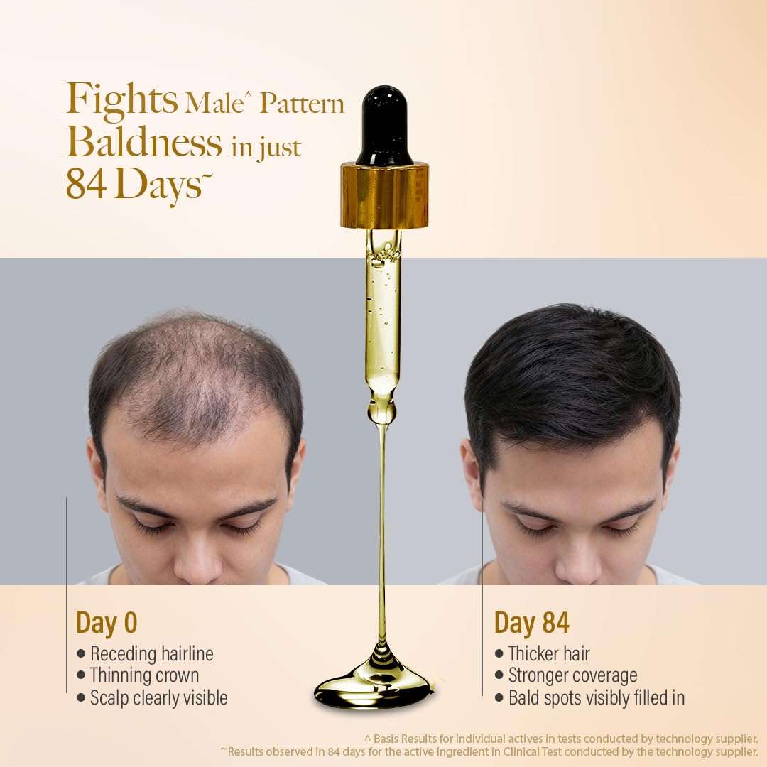 Kesh King Gold Advanced Hair Growth Serum – 21% Growth Actives with 3% Redensyl, 3% Anagain, Procapil, Kopexil Aqua & Ayurvedic Herbs | Visible Regrowth & Hair Fall Control | Women & Men | 30ml