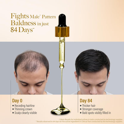 Kesh King Gold Advanced Hair Growth Serum – 21% Growth Actives with 3% Redensyl, 3% Anagain, Procapil, Kopexil Aqua & Ayurvedic Herbs | Visible Regrowth & Hair Fall Control | Women & Men | 30ml