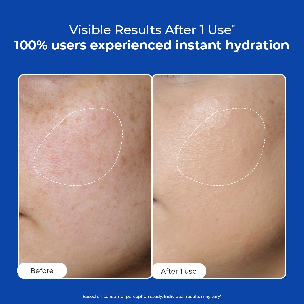 Before and after comparison of skin hydration with a blue background and text about user experience.