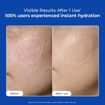 Before and after comparison of skin hydration with a blue background and text about user experience.