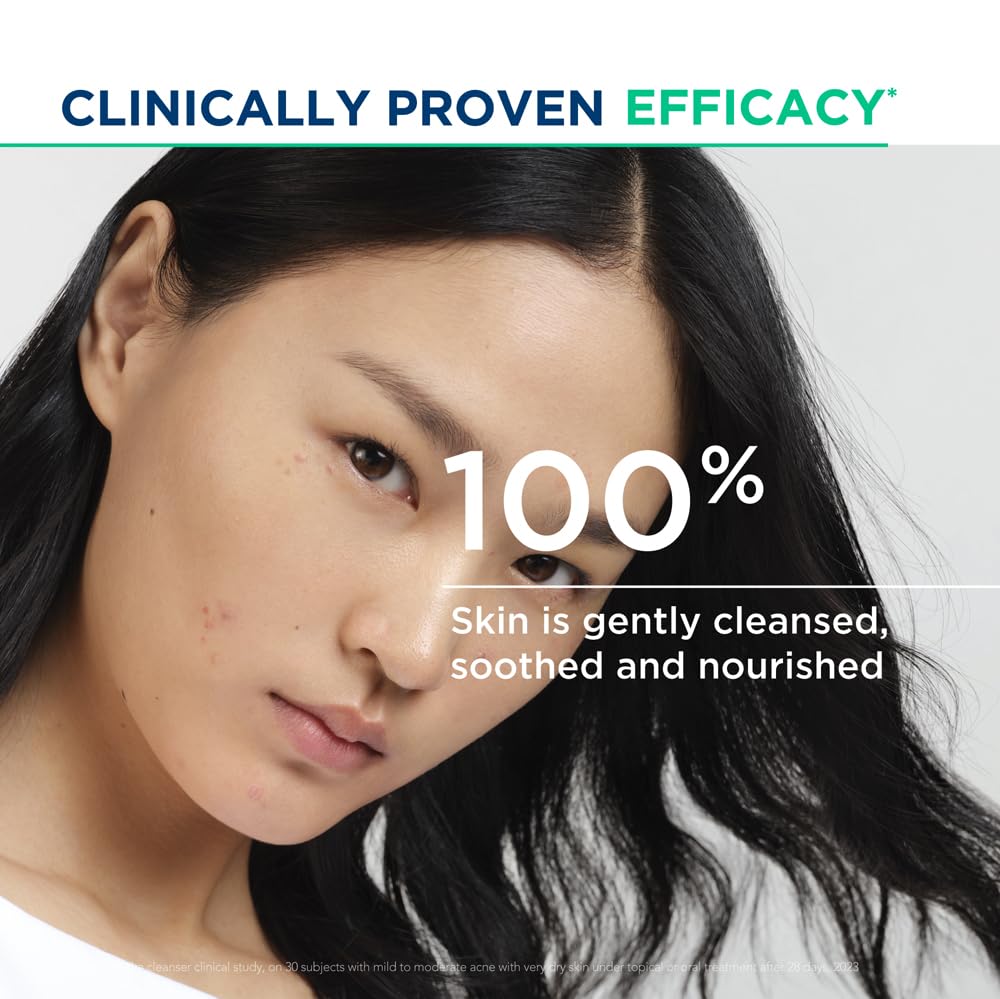 Woman with acne-prone skin showing text about clinically proven efficacy and skin care benefits.