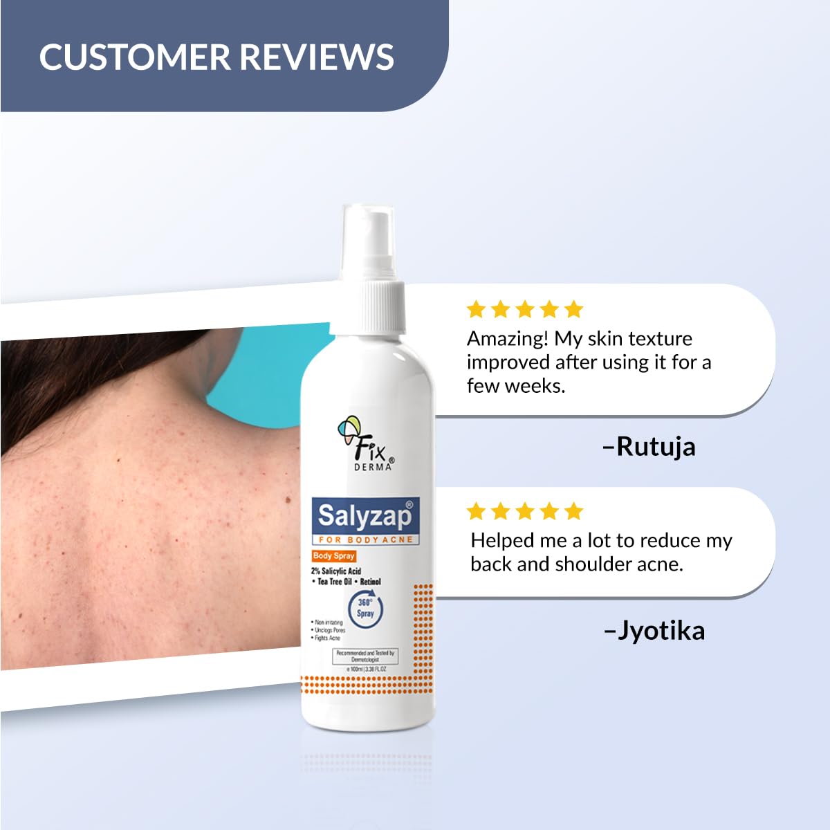 Fixderma 2% Salicylic Acid Salyzap Body Acne Spray For Acne on Back, Shoulders, Neck & Chest to improve Breakouts & Uneven skin texture for Women & Men - 100ml