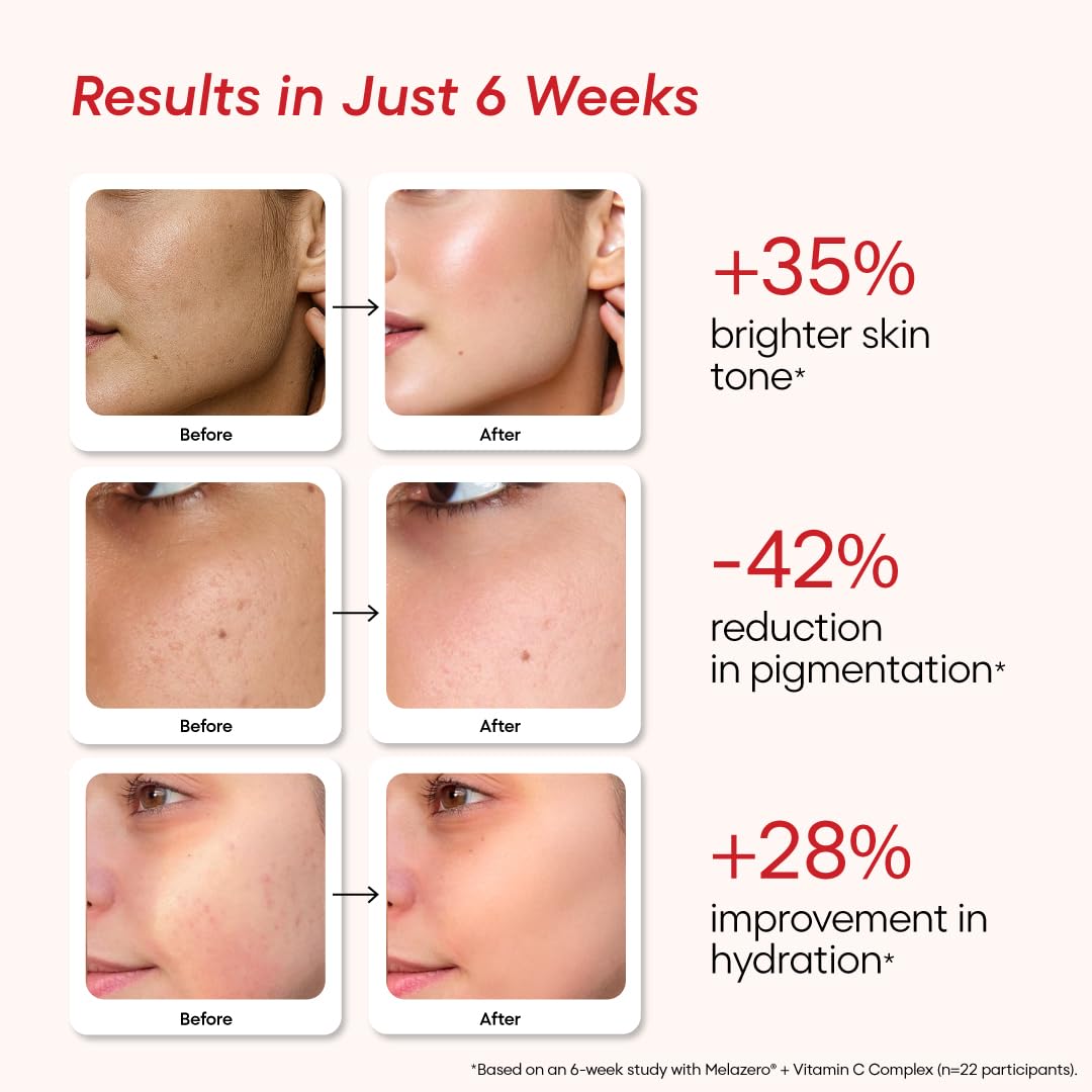Reglow Face Serum | 15% Vitamin C Complex, Claire Blanche II, Melazero & Hyaluronic Acid |Advanced Pigmentation Control, Dark Spots, Protects Against Pollution and UV | 30 ML