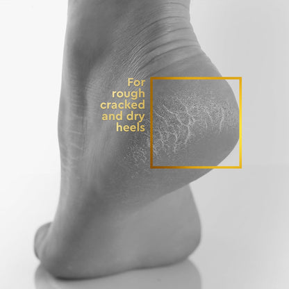 VLCC Clinic Heel Repair Cream - 100g | Exfoliating and Moisturizing Foot and Heel Cream | Softer, Supple, Smoother Feet | Dermatologically Tested | Hydrating Cream for Dry and Cracked Heels
