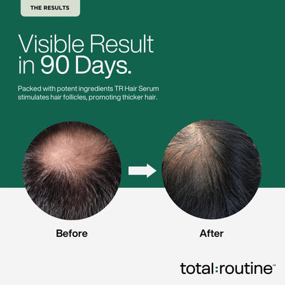 Before and after comparison of hair growth with 'total:routine' branding on a green background.
