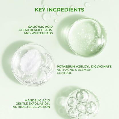 YUDERMA Sebalex Face Wash for Oily and Acne Prone Skin, 100gm Medi-Acne Face Wash & Mask, Sulphate & Paraben Free, Non-Comedogenic Face Wash for Women and Men