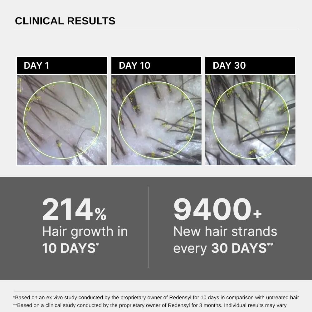 Bare Anatomy Expert Anti-Hair Fall Shampoo (250ml) & Advanced Hair Growth Serum (30ml) | Adenosine, Peptides, Redensyl, Rice Water, & Rosemary | Hair Growth & Hair Fall Control Combo for Women & Men
