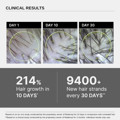 Bare Anatomy Expert Anti-Hair Fall Shampoo (250ml) & Advanced Hair Growth Serum (30ml) | Adenosine, Peptides, Redensyl, Rice Water, & Rosemary | Hair Growth & Hair Fall Control Combo for Women & Men
