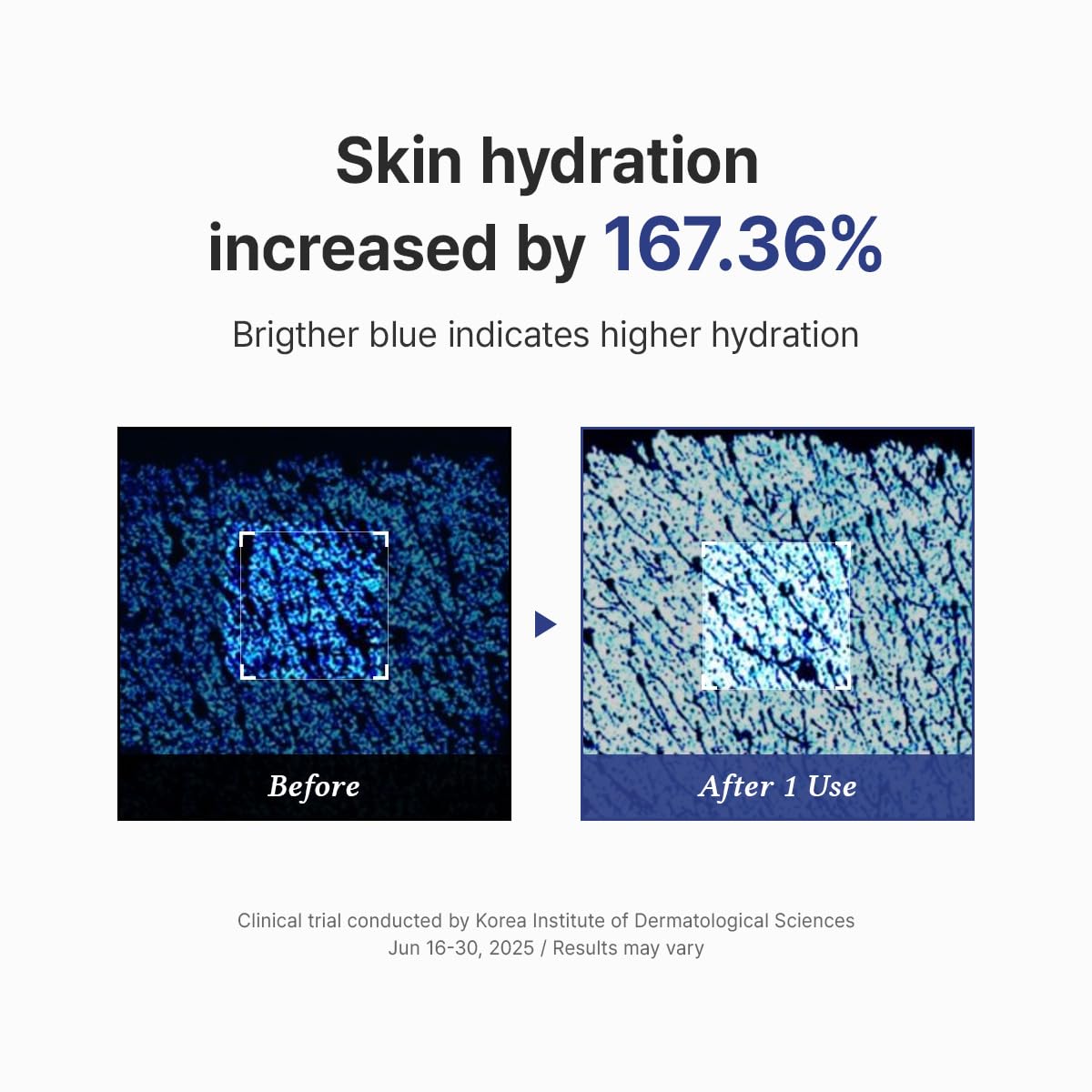 Before and after comparison of skin hydration with a blue color gradient indicating higher hydration.