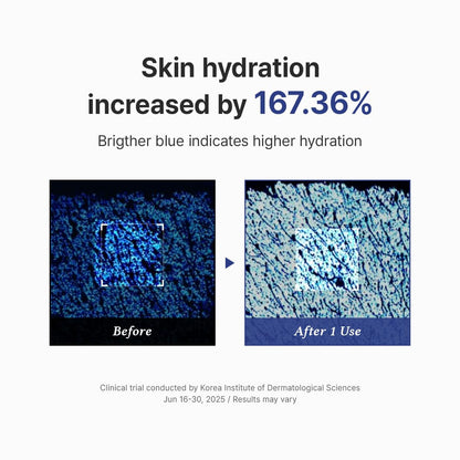 Before and after comparison of skin hydration with a blue color gradient indicating higher hydration.