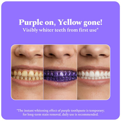 Perfora Purple Whitening Toothpaste-125g | Purple Toothpaste For Teeth Whitening | Teeth Stain Remover | Enamel Safe & Effective Teeth Whitener Oral care | Grape Mint
