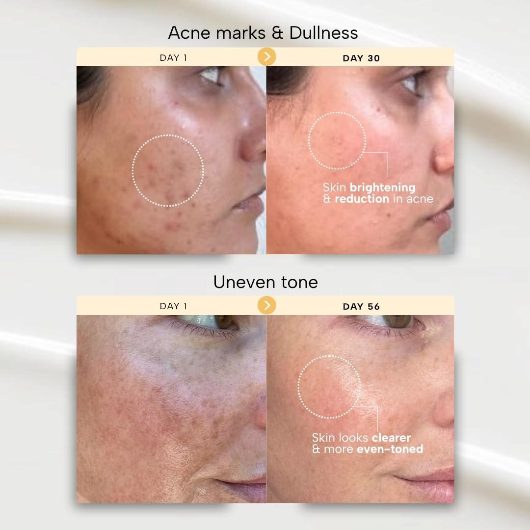 RAS Luxury Oils Radiance 24K Gold Brightening 8 in 1 Face Gel Serum Hydrates Skin, Reduce Pigmentation, With 148 Hours of Hydration Infused with Hyaluronic Acid, Saffron, Manjistha & Rosehip