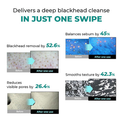 Product advertisement showing before and after effects with text about deep blackhead cleanse.