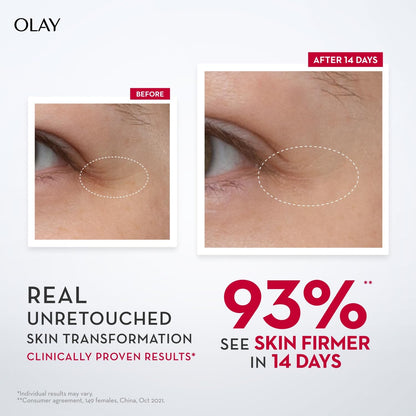 Advertisement for Olay skin firming product showing before and after effects on eye area.