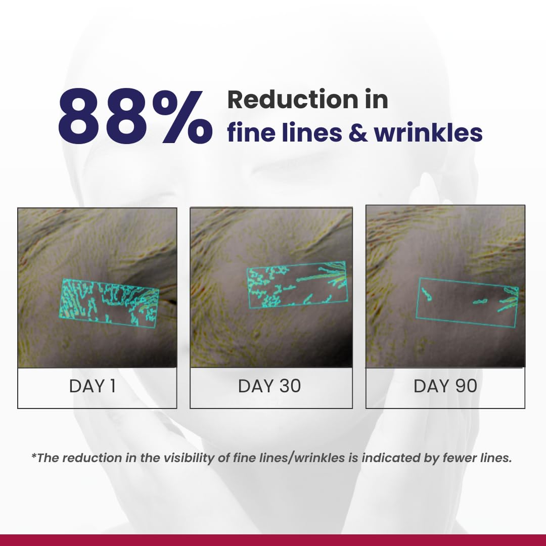 RE' EQUIL 0.1% Retinol Night Cream | Repairs Wrinkles & Fine Lines | Improves Skin Firmness | Beginner Friendly | All Skin Types | 30G