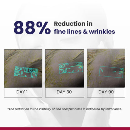 RE' EQUIL 0.1% Retinol Night Cream | Repairs Wrinkles & Fine Lines | Improves Skin Firmness | Beginner Friendly | All Skin Types | 30G