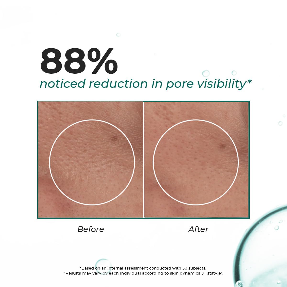 Before and after comparison of pore visibility with text indicating 88% reduction.