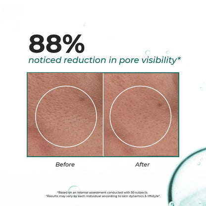 Before and after comparison of pore visibility with text indicating 88% reduction.