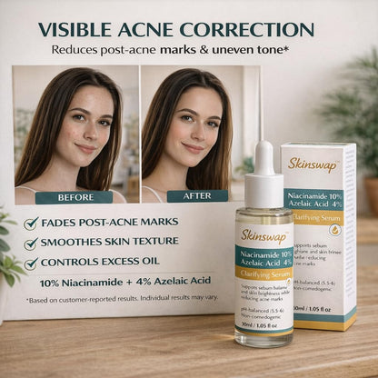 Skinswap acne correction product with 'Before' and 'After' effects on a woman's skin.