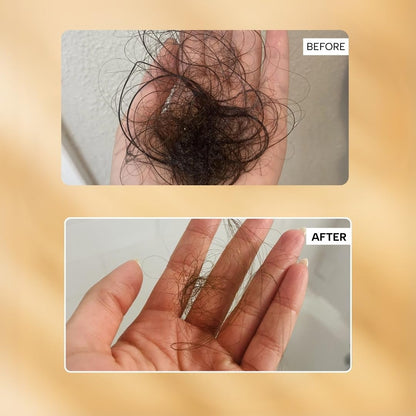 RAS Root-ine™ Hair Growth Serum with 19.5% Scalp Actives | Redensyl & Anagain | Promotes Hair Growth, Stimulates Hair Follicles & Regrowth | Controls Hair Fall & Increases Hair Density | Hair Growth Serum for Women & Men