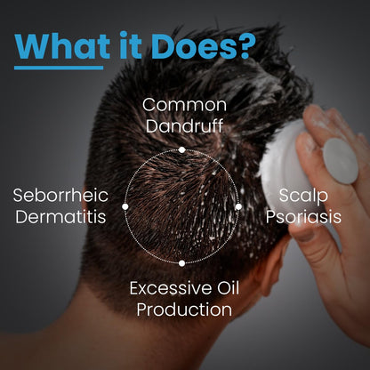 FCL T-Shampoo For Dandruff, Itchy Scalp, Scalp Psoriasis & Seborrheic Dermatitis | Removes Excess Oil & Flake Free Scalp | Anti Dandruff Shampoo | Sulphate & Paraben Free | For Sensitive Skin - 200 ml