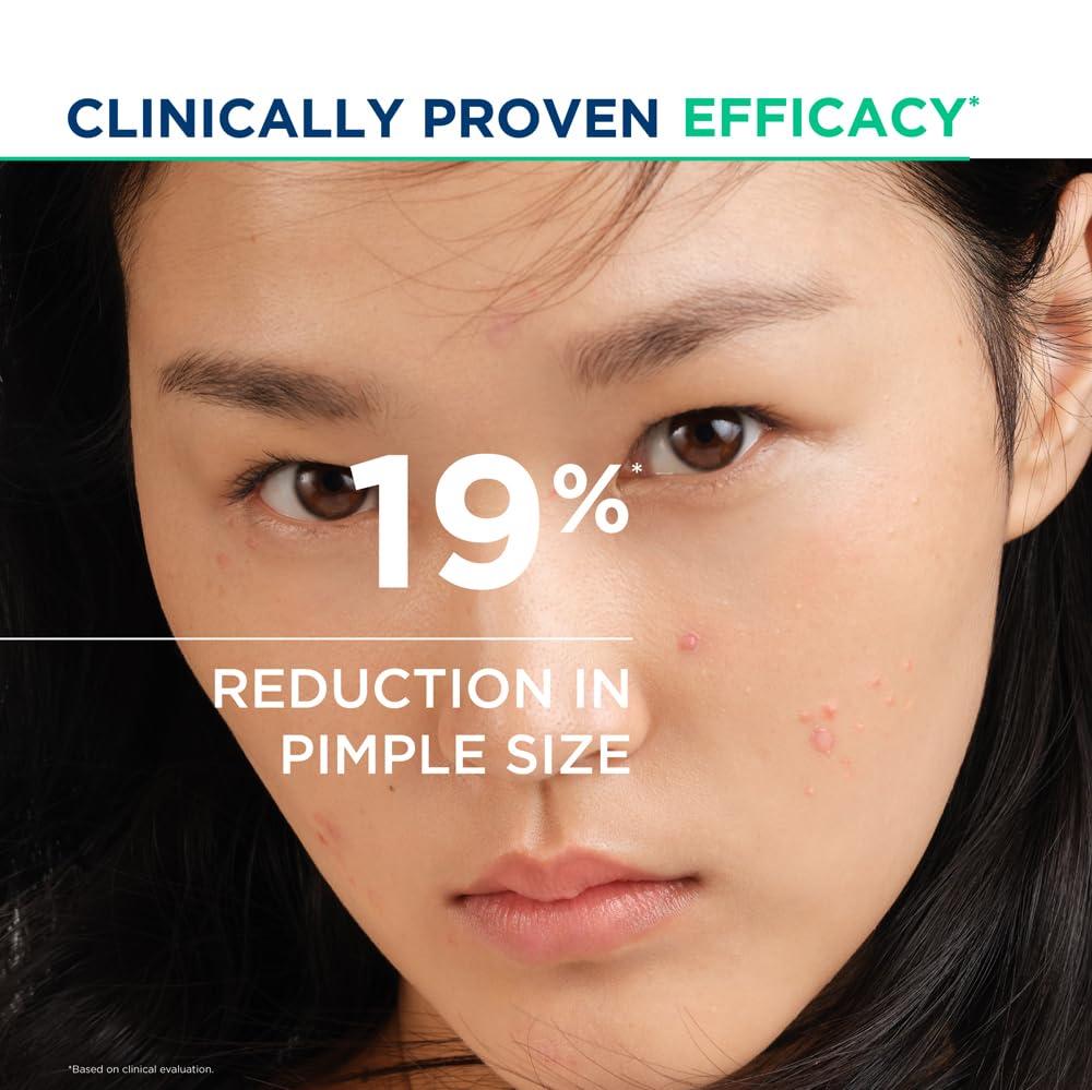 Advertisement showing a person's face with acne and text about clinically proven efficacy and pimple size reduction.