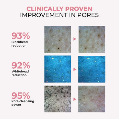 Cosmetic product claims with before and after images showing blackhead, whitehead reduction, and pore cleansing power.