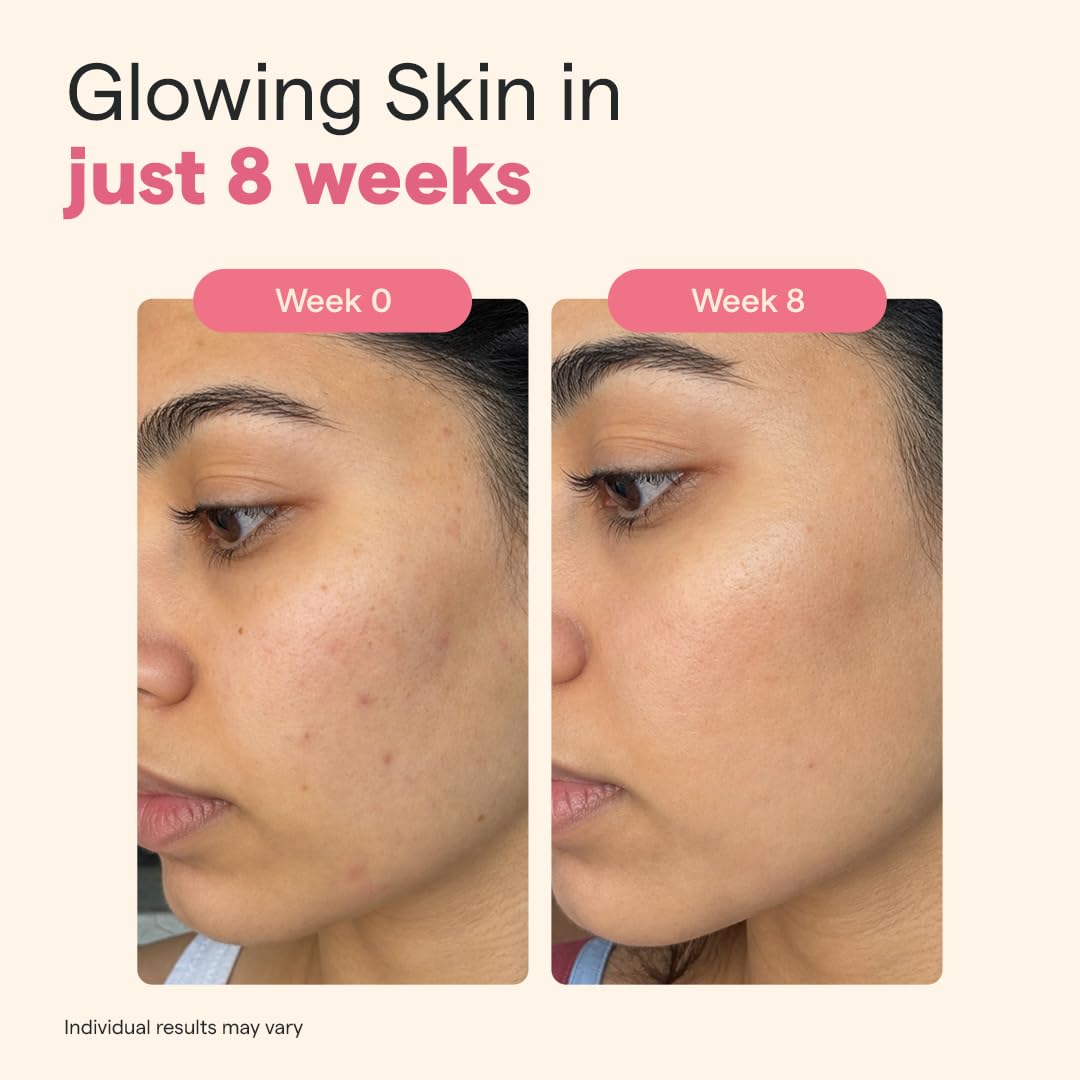 The Good Bug Gluta Glow Effervescent Tablets for Radiant Skin - 15 Tablets (Pack of 15 x 1) | L-Glutathione, Vitamin C, Lycopene For Skin Glow & Anti-Pigmentation | Strawberry Lemon|No Added Sugar
