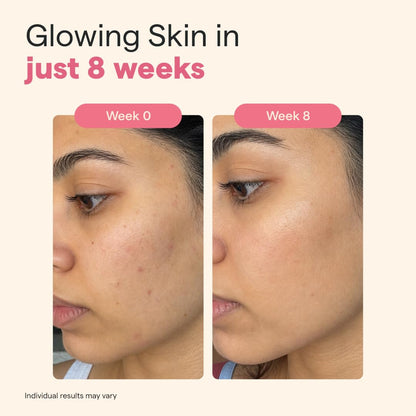 The Good Bug Gluta Glow Effervescent Tablets for Radiant Skin - 15 Tablets (Pack of 15 x 1) | L-Glutathione, Vitamin C, Lycopene For Skin Glow & Anti-Pigmentation | Strawberry Lemon|No Added Sugar