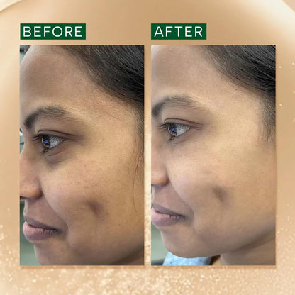 RAS Luxury Oils Brightening & Anti-Pigmentation Advanced Booster Serum