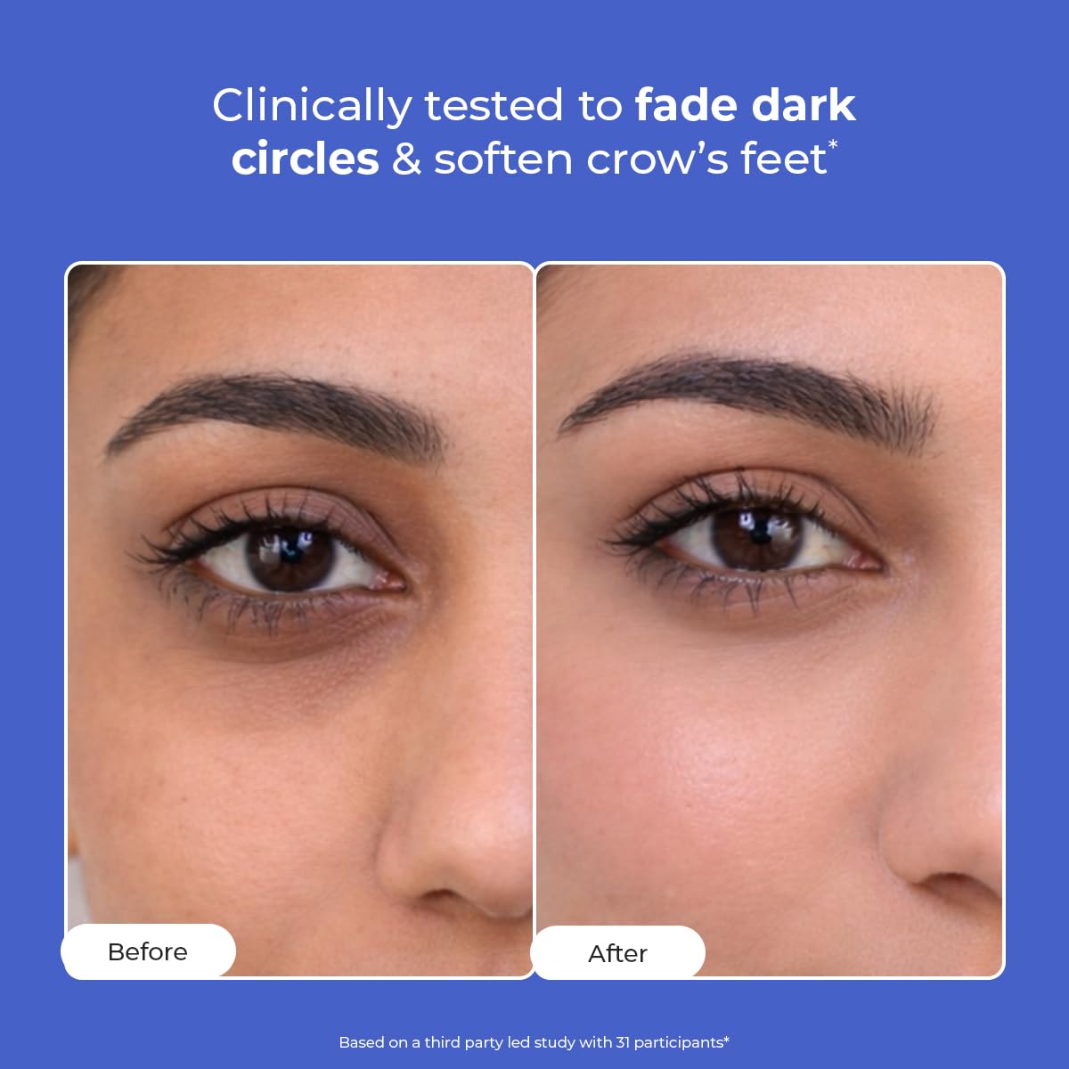 Conscious Chemist® Retinol Peptide Under Eye Cream With Soothing Massage Roller | Under Eye Roll On For Dark Circles, Fine Lines & Puffy Eyes | For Women & Men | 15 ml