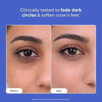Conscious Chemist® Retinol Peptide Under Eye Cream With Soothing Massage Roller | Under Eye Roll On For Dark Circles, Fine Lines & Puffy Eyes | For Women & Men | 15 ml