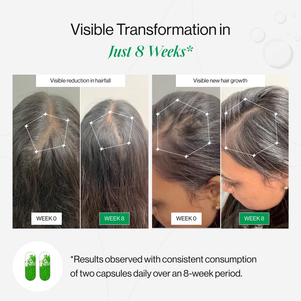 Before and after comparison of hair health with visible transformation in 8 weeks, showing reduction in hairfall and new hair growth.