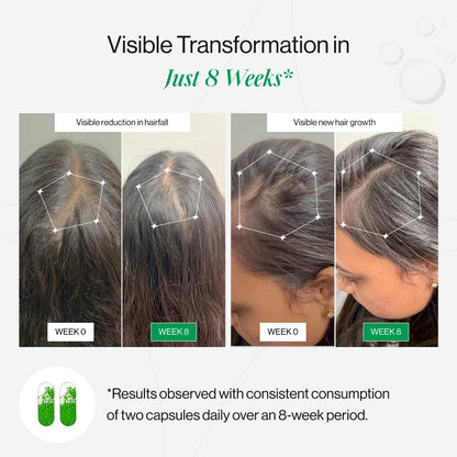 Before and after comparison of hair health with visible transformation in 8 weeks, showing reduction in hairfall and new hair growth.