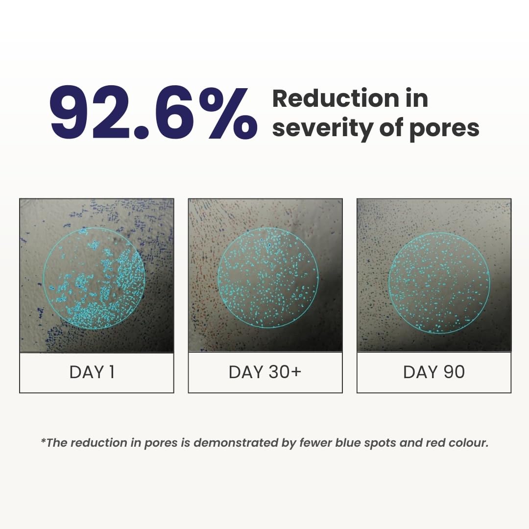 Graphical representation of pore reduction over time with blue spots and red color intensity shown on a white background.